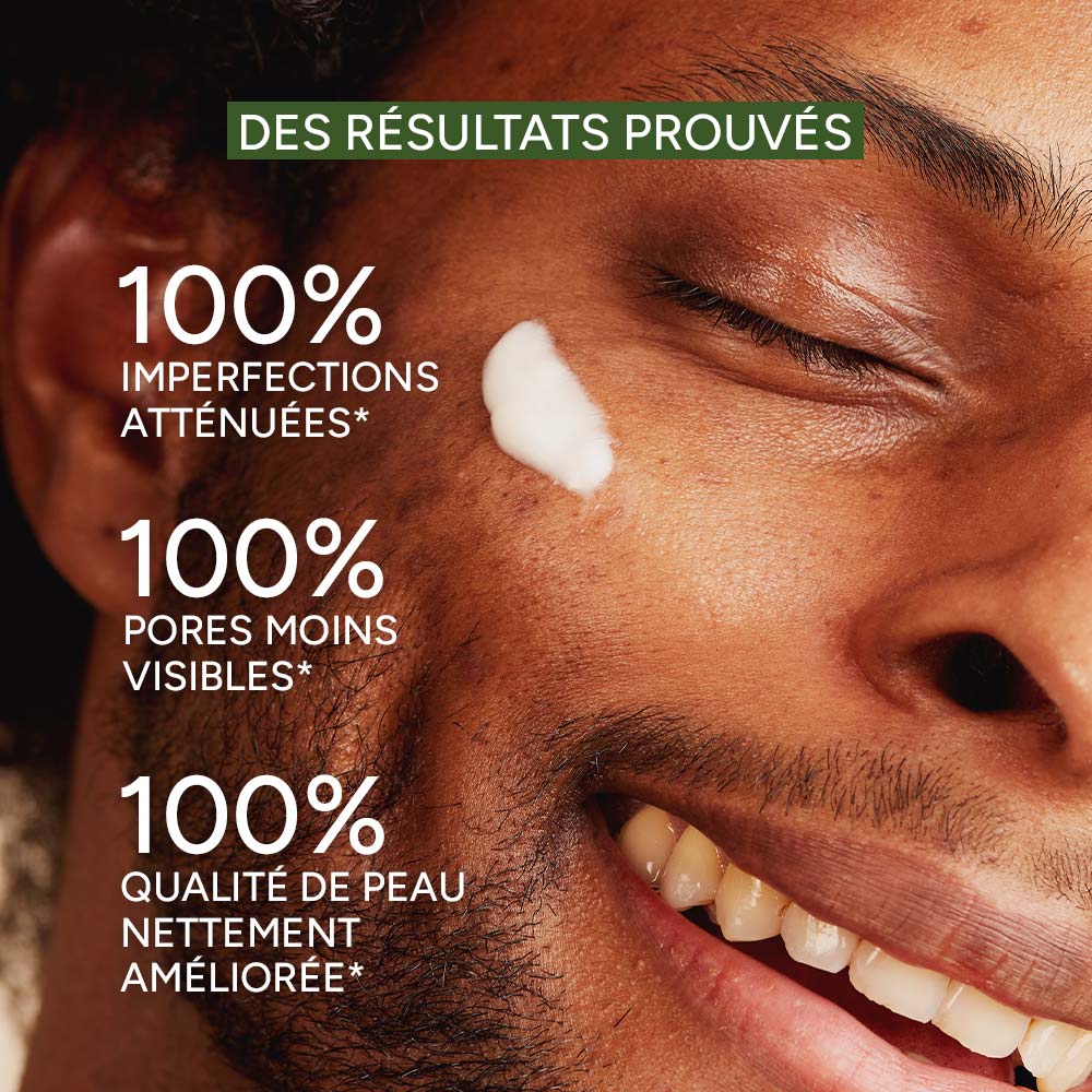 Le sérum anti-imperfections